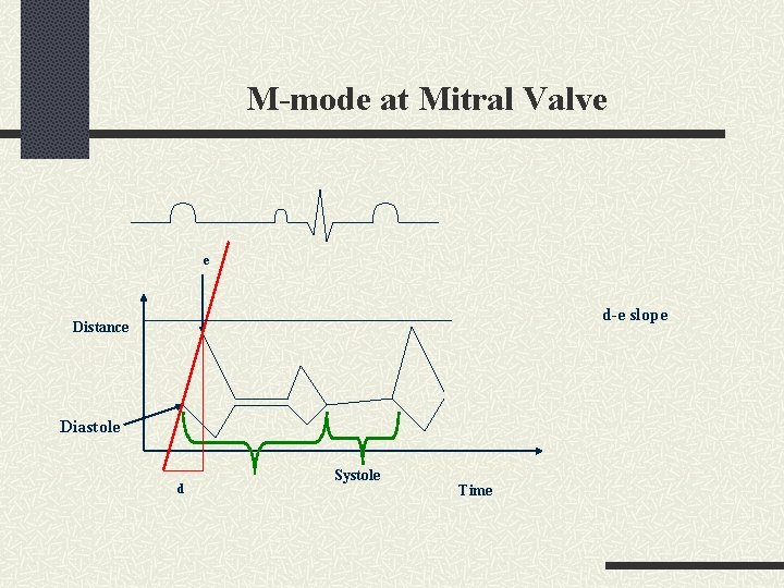 M-mode at Mitral Valve e d-e slope Distance Diastole d Systole Time 