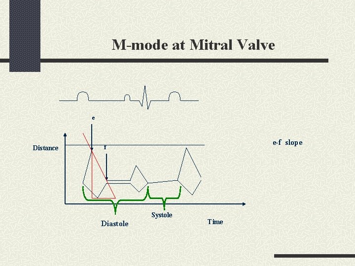 M-mode at Mitral Valve e Distance e-f slope f Systole Diastole Time 