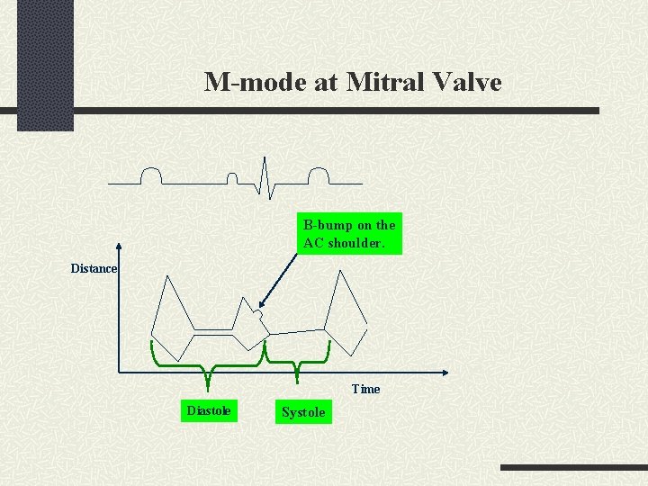 M-mode at Mitral Valve B-bump on the AC shoulder. Distance Time Diastole Systole 