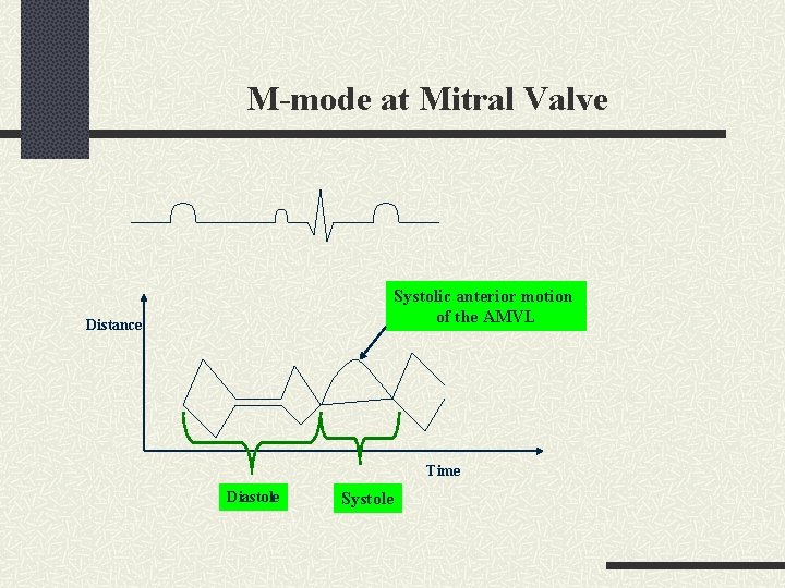 M-mode at Mitral Valve Systolic anterior motion of the AMVL Distance Time Diastole Systole