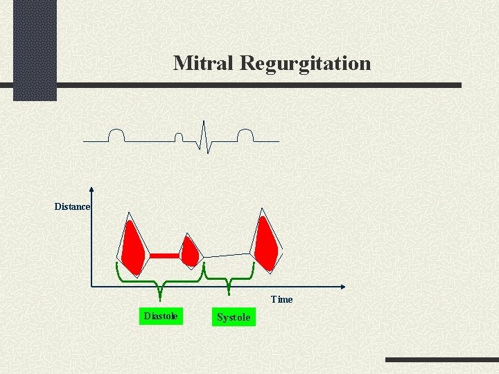 Mitral Regurgitation Distance Time Diastole Systole 