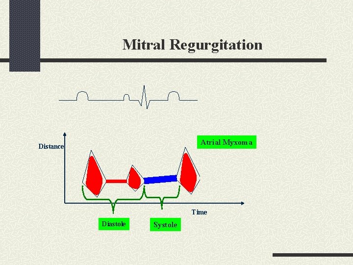 Mitral Regurgitation Atrial Myxoma Distance Time Diastole Systole 