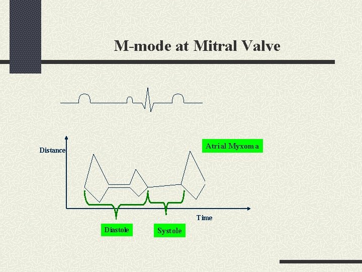 M-mode at Mitral Valve Atrial Myxoma Distance Time Diastole Systole 