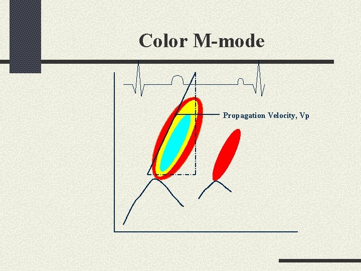 Color M-mode Propagation Velocity, Vp 
