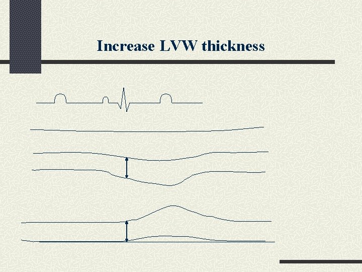 Increase LVW thickness 