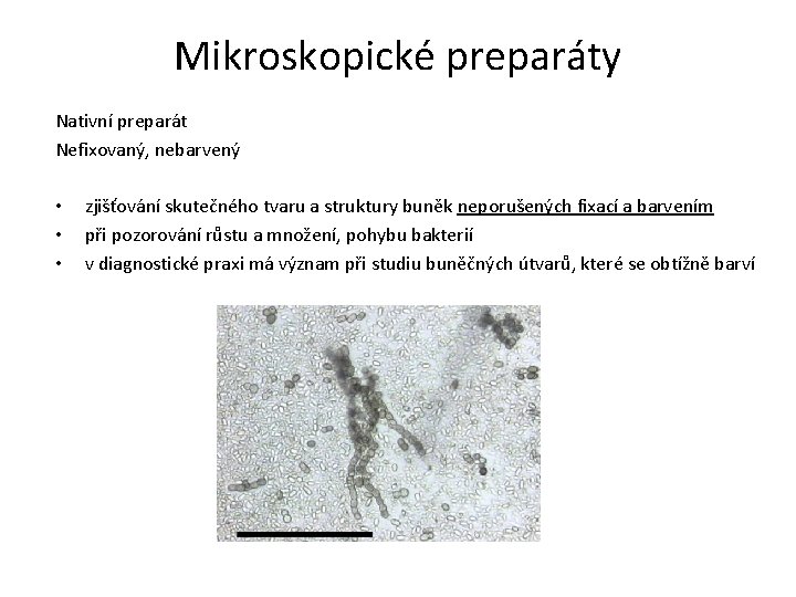 Mikroskopické preparáty Nativní preparát Nefixovaný, nebarvený • • • zjišťování skutečného tvaru a struktury
