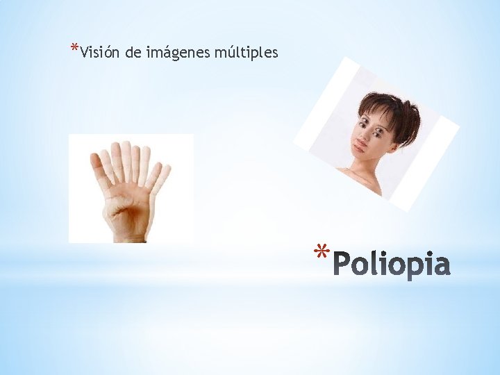 *Visión de imágenes múltiples * 