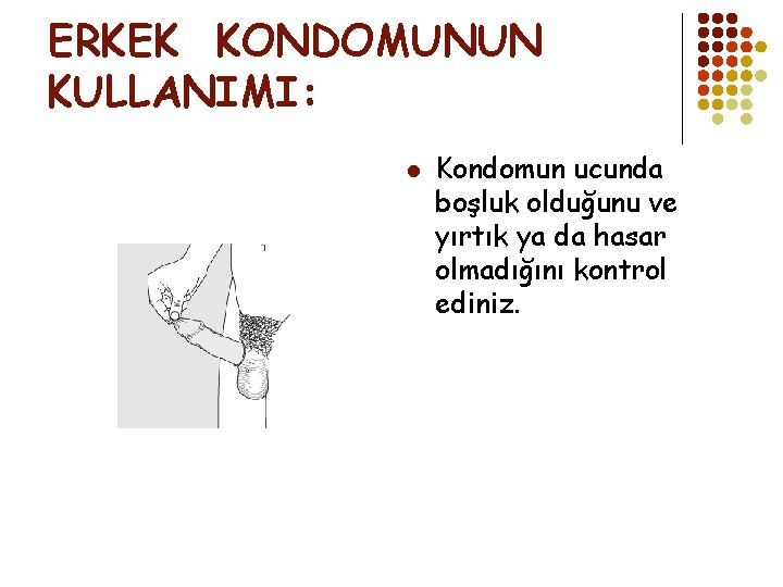 ERKEK KONDOMUNUN KULLANIMI: l Kondomun ucunda boşluk olduğunu ve yırtık ya da hasar olmadığını