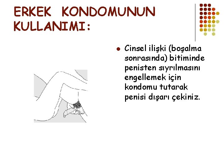 ERKEK KONDOMUNUN KULLANIMI: l Cinsel ilişki (boşalma sonrasında) bitiminde penisten sıyrılmasını engellemek için kondomu