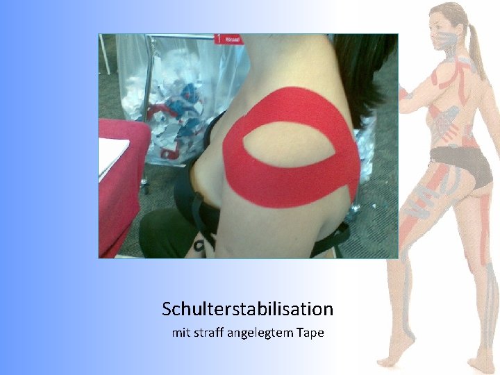 Schulterstabilisation mit straff angelegtem Tape 