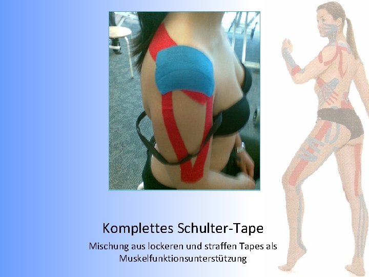 Komplettes Schulter-Tape Mischung aus lockeren und straffen Tapes als Muskelfunktionsunterstützung 