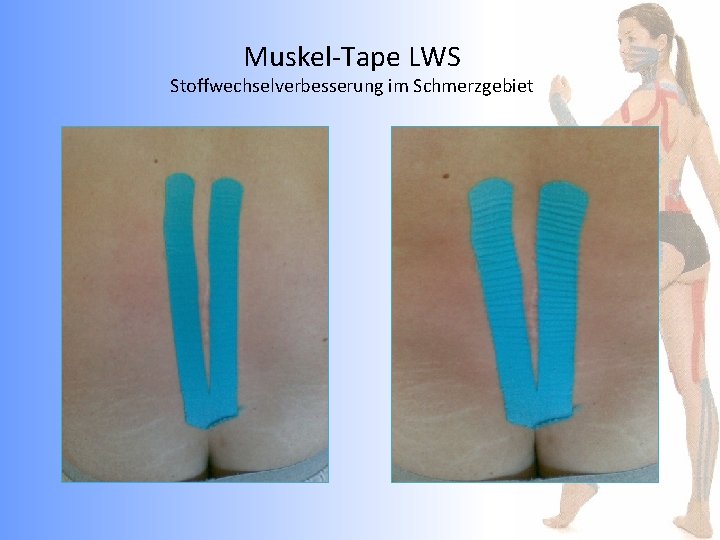 Muskel-Tape LWS Stoffwechselverbesserung im Schmerzgebiet 
