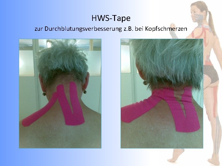 HWS-Tape zur Durchblutungsverbesserung z. B. bei Kopfschmerzen 