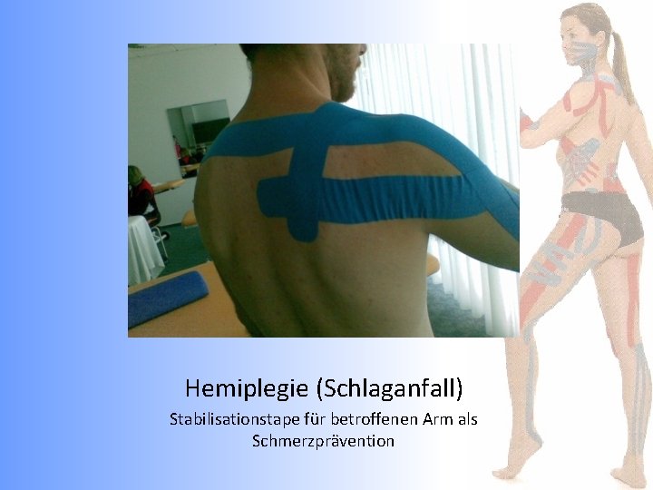 Hemiplegie (Schlaganfall) Stabilisationstape für betroffenen Arm als Schmerzprävention 