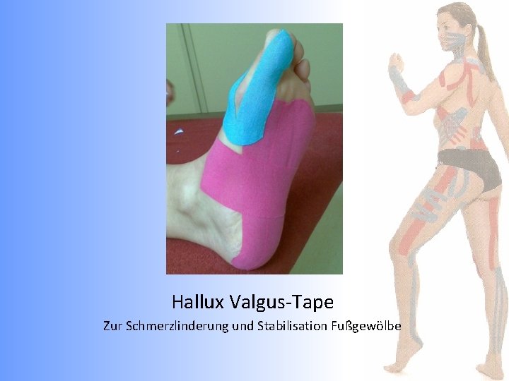 Hallux Valgus-Tape Zur Schmerzlinderung und Stabilisation Fußgewölbe 