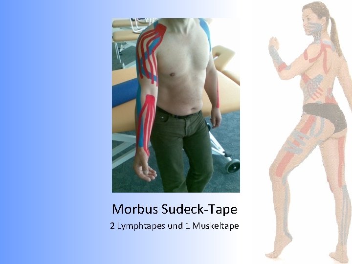 Morbus Sudeck-Tape 2 Lymphtapes und 1 Muskeltape 