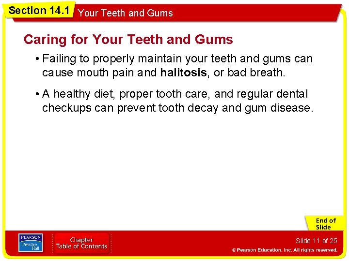 Section 14. 1 Your Teeth and Gums Caring for Your Teeth and Gums •