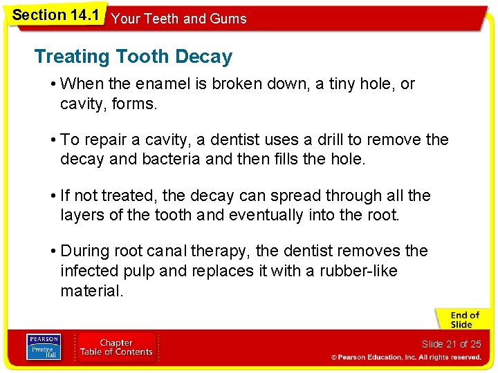 Section 14. 1 Your Teeth and Gums Treating Tooth Decay • When the enamel