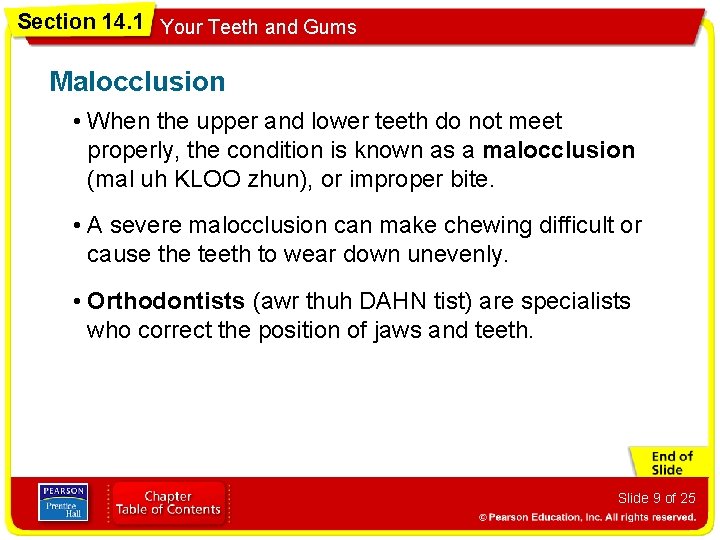 Section 14. 1 Your Teeth and Gums Malocclusion • When the upper and lower