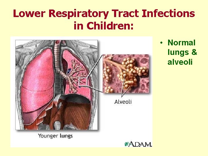 Lower Respiratory Tract Infections in Children: • Normal lungs & alveoli 