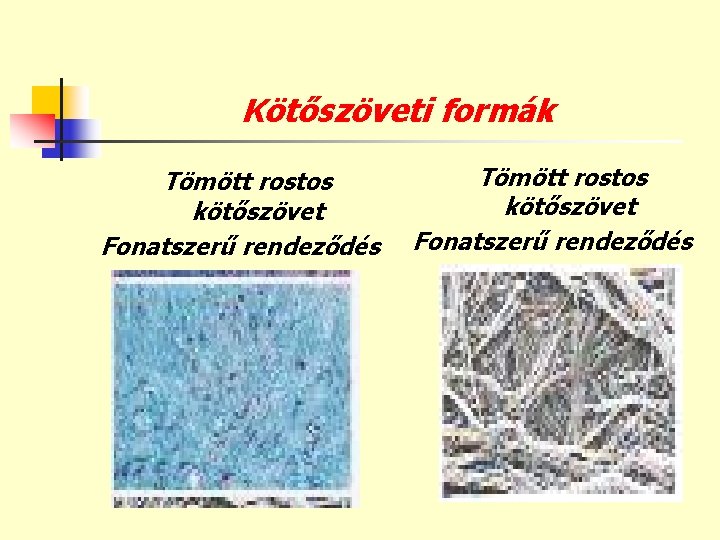 Kötőszöveti formák Tömött rostos kötőszövet Fonatszerű rendeződés 