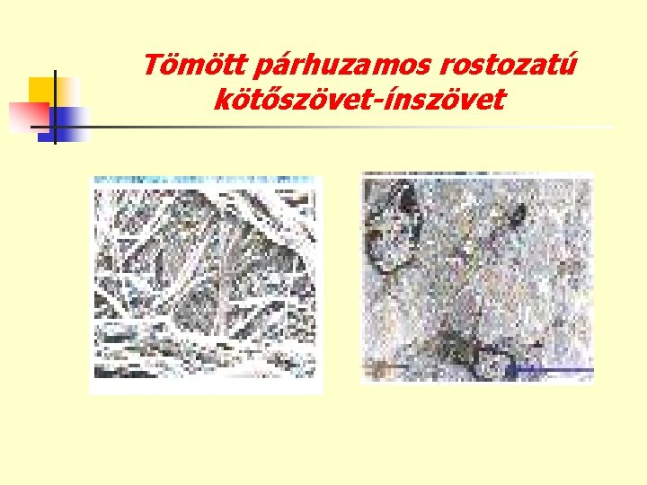 Tömött párhuzamos rostozatú kötőszövet-ínszövet 