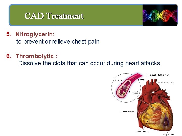 CAD Treatment 5. Nitroglycerin: to prevent or relieve chest pain. 6. Thrombolytic : Dissolve