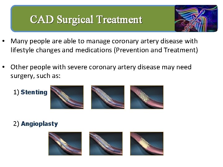 CAD Surgical Treatment • Many people are able to manage coronary artery disease with