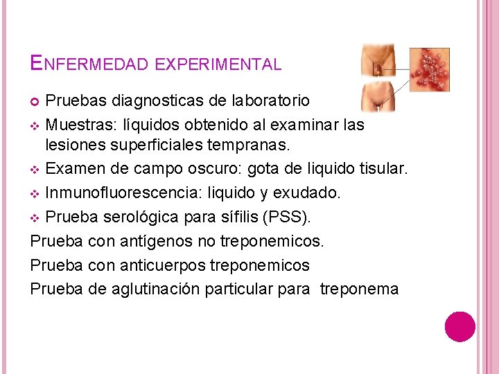 ENFERMEDAD EXPERIMENTAL Pruebas diagnosticas de laboratorio v Muestras: líquidos obtenido al examinar las lesiones