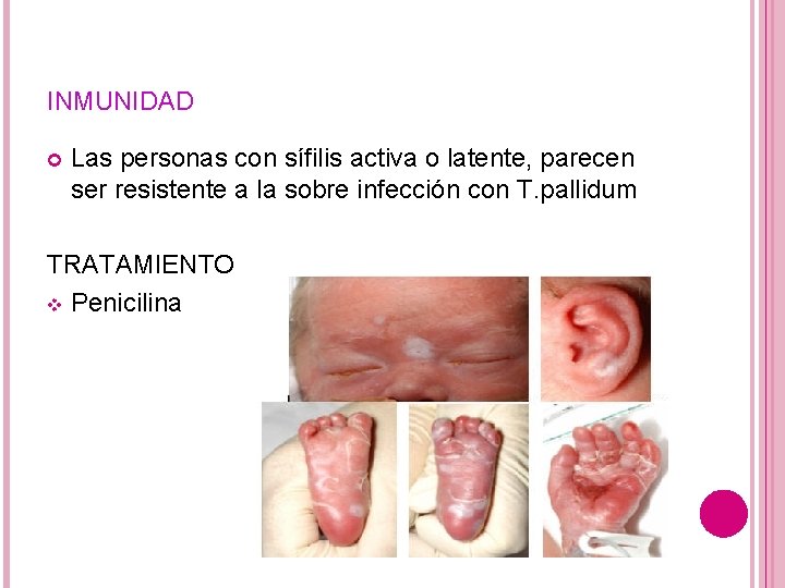 INMUNIDAD Las personas con sífilis activa o latente, parecen ser resistente a la sobre