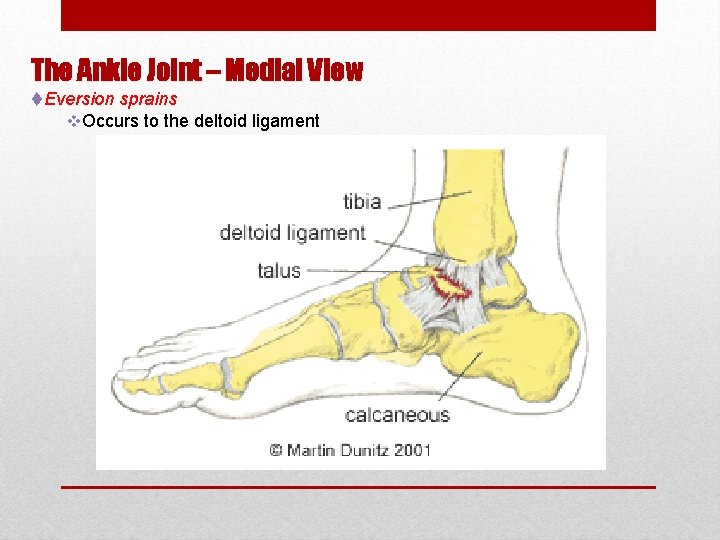 The Ankle Joint – Medial View t. Eversion sprains v. Occurs to the deltoid