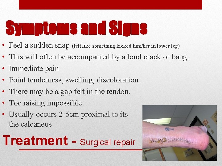 Symptoms and Signs • • Feel a sudden snap (felt like something kicked him/her