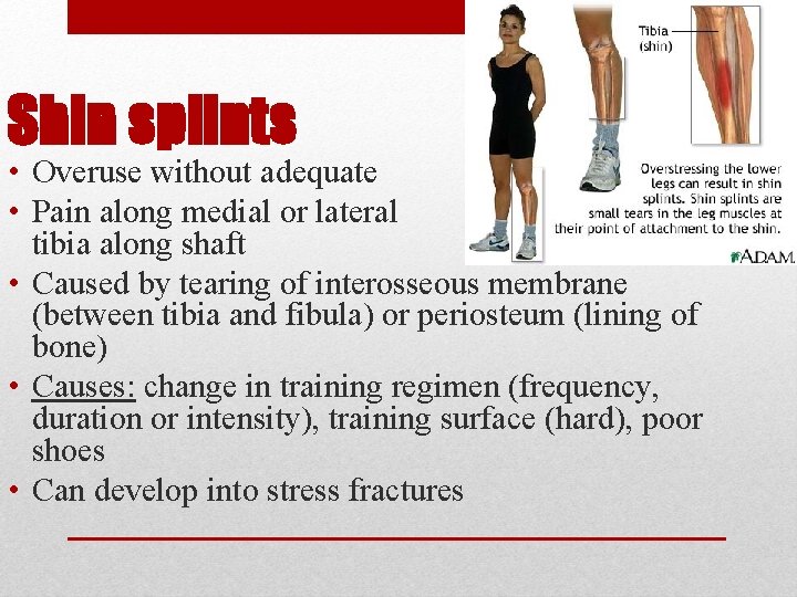 Shin splints • Overuse without adequate recovery • Pain along medial or lateral side