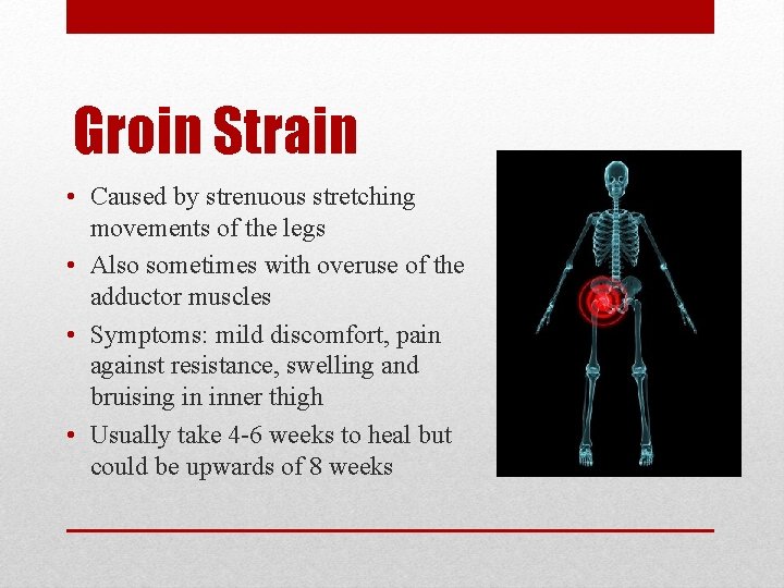 Groin Strain • Caused by strenuous stretching movements of the legs • Also sometimes