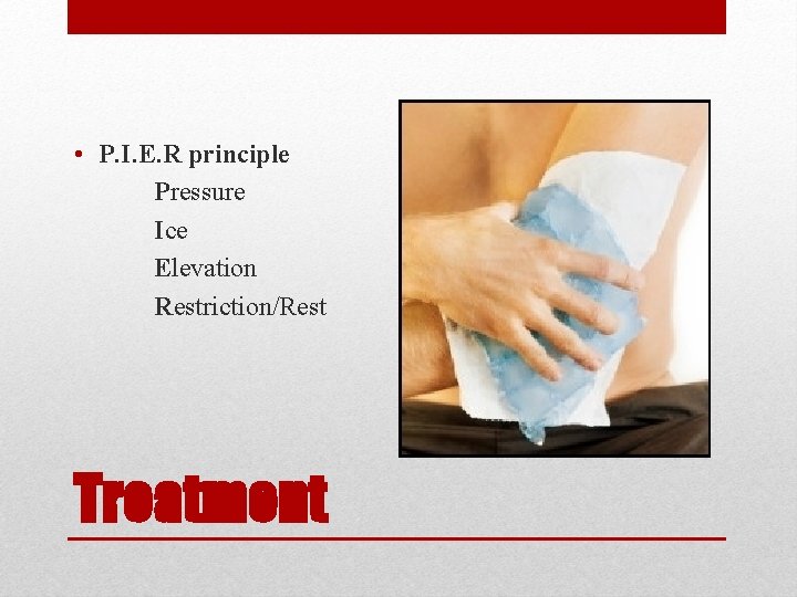  • P. I. E. R principle Pressure Ice Elevation Restriction/Rest Treatment 