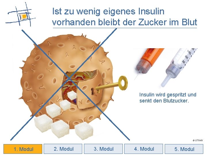 Ist zu wenig eigenes Insulin vorhanden bleibt der Zucker im Blut Insulin wird gespritzt