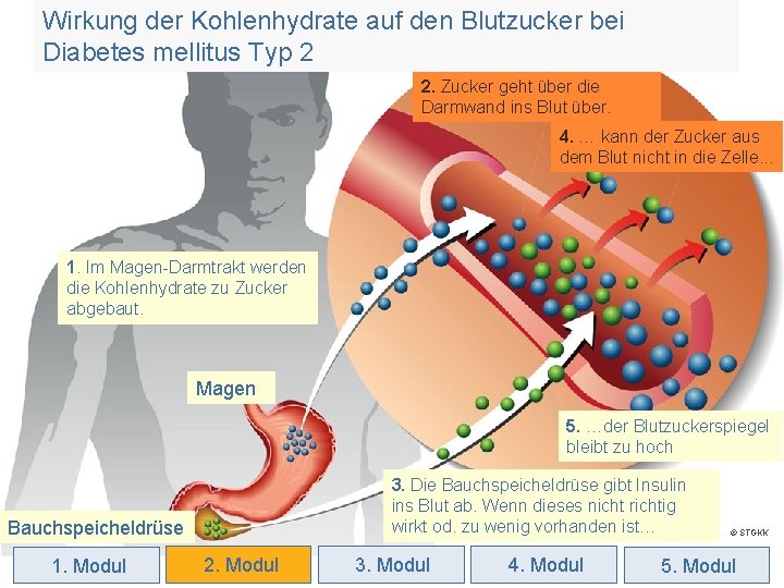 Wirkung der Kohlenhydrate auf den Blutzucker bei Diabetes mellitus Typ 2 2. Zucker geht