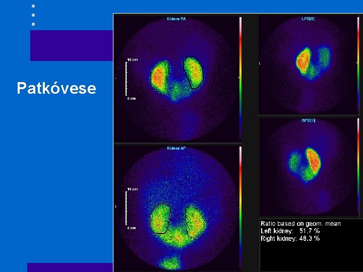 Patkóvese 