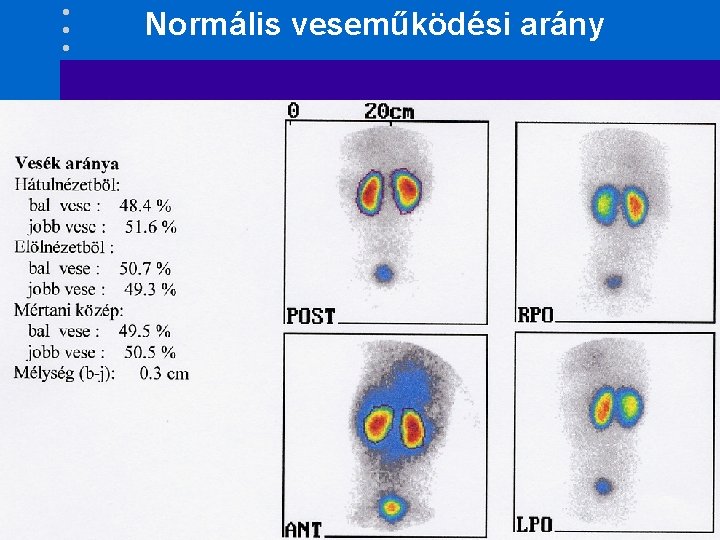 Normális veseműködési arány 