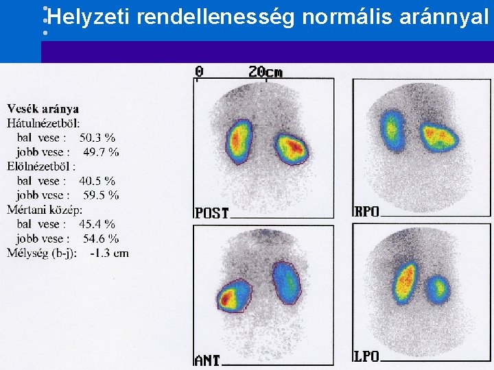 Helyzeti rendellenesség normális aránnyal 