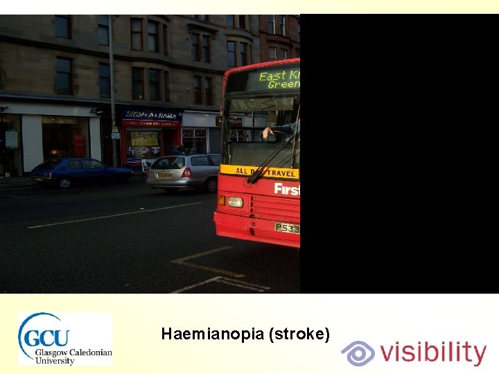 Bus normal view Haemianopia (stroke) 