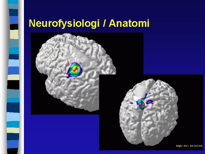 Neurofysiologi / Anatomi 