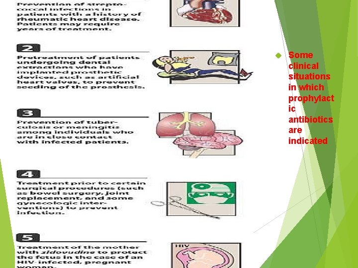  Some clinical situations in which prophylact ic antibiotics are indicated 