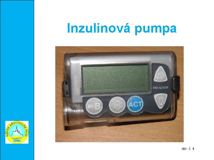 Inzulinová pumpa obr. č. 4 