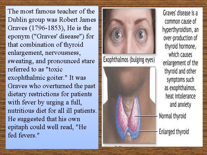 The most famous teacher of the Dublin group was Robert James Graves (1796 -1853),