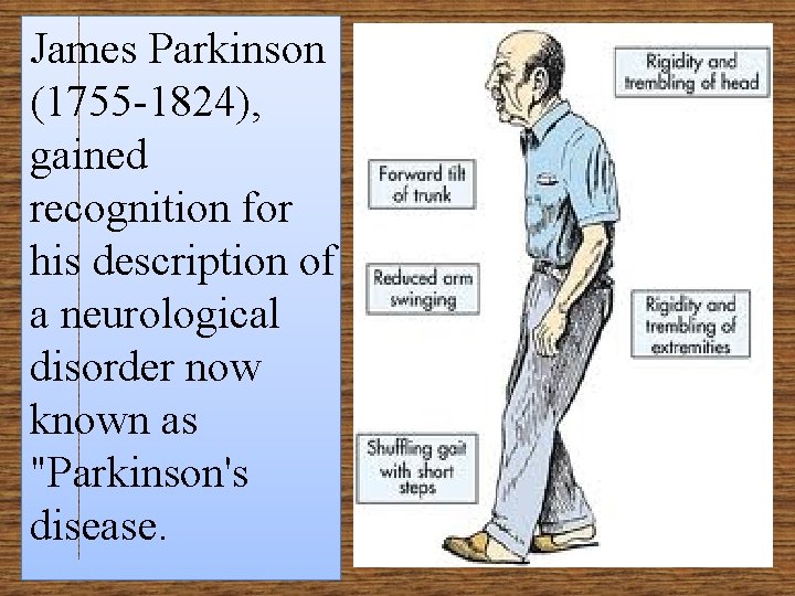 James Parkinson (1755 -1824), gained recognition for his description of a neurological disorder now