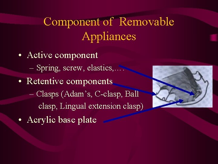 Component of Removable Appliances • Active component – Spring, screw, elastics, …. • Retentive