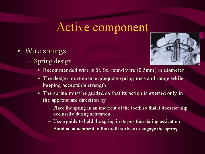 Active component • Wire springs – Spring design • Recommended wire is St. round