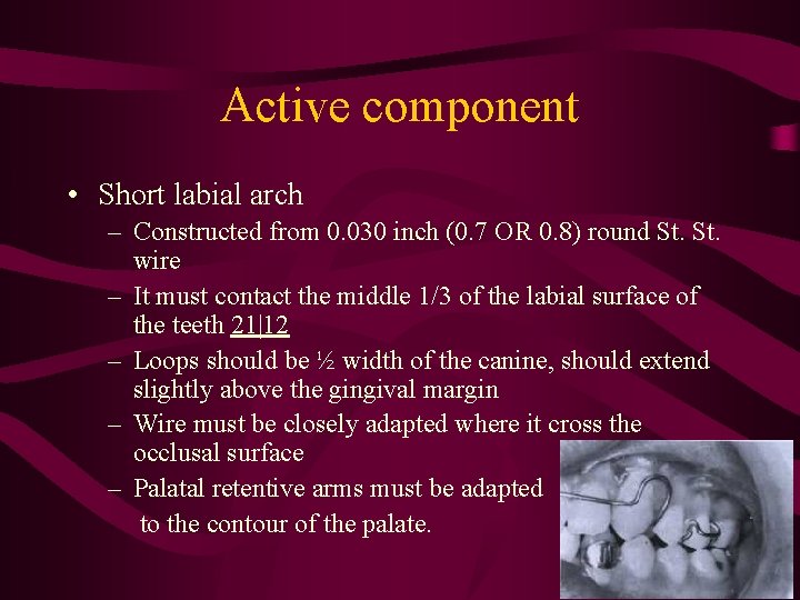 Active component • Short labial arch – Constructed from 0. 030 inch (0. 7