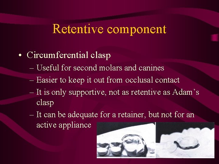 Retentive component • Circumferential clasp – Useful for second molars and canines – Easier